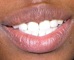 Slider image (9) PruDent-Hungary